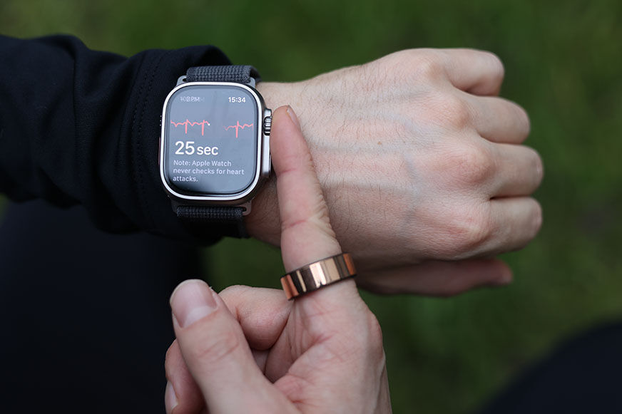 Функция ЭКГ на Apple Watch Ultra. 